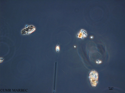 phyto/French_Polynesia/Moorea/PHYTOCONT June 2015/Prorocentrum triestinum (150730_001_ovl-10).tif(copy)_thumb.jpg